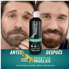 🎁 3x1: El Kit Shampoo Natural que Elimina las Canas 😍🖤