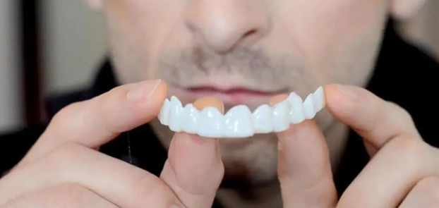 Montura Carillas dentales postizas