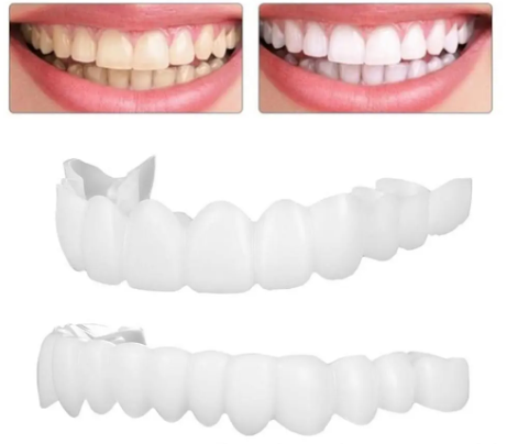 Montura Carillas dentales postizas